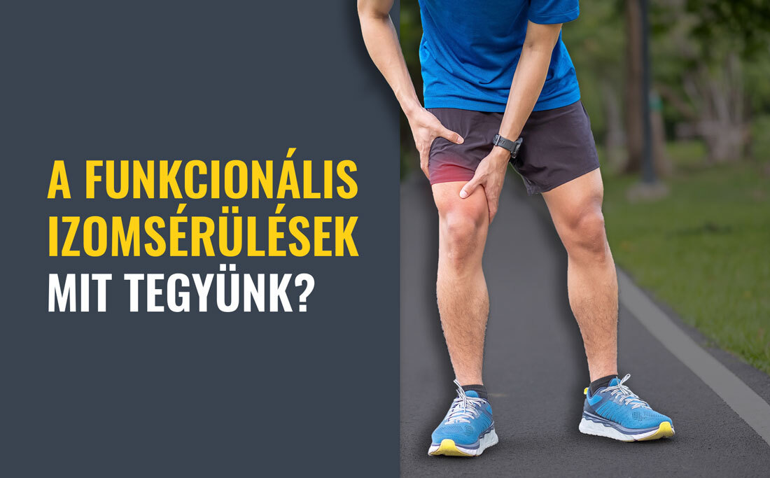 A funkcionális izomsérülések: hogyan ismerjük fel és mit tegyünk?